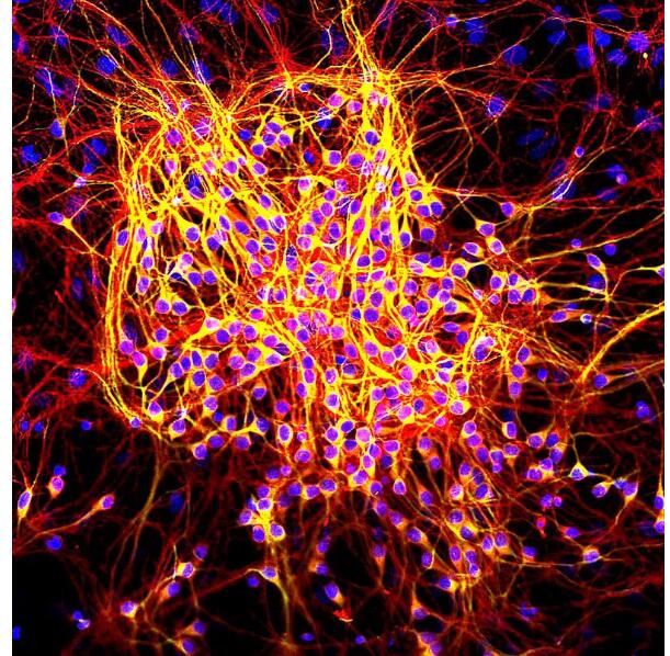 《细胞》子刊：误解四十年！华人科学家发现，阿尔茨海默相关tau蛋白的真实功能我们可能搞反了