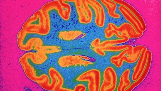 男大脑比女的略大?大惊小怪!功能上又没啥差别