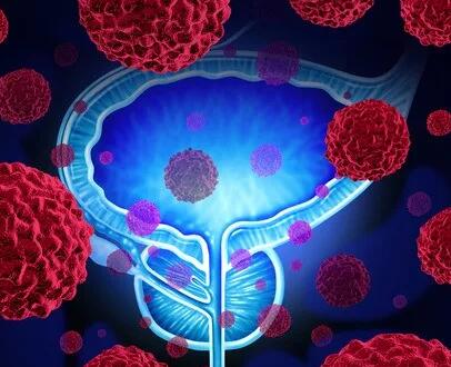 基因组算法立功！发现膀胱癌新靶点