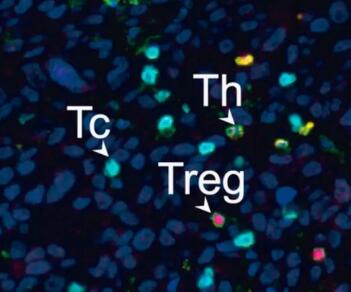 《自然》：科学家首次证实，肿瘤中存在大量与癌症不相关的“吃瓜”杀伤性T细胞，难怪有些患者对免疫治疗没反应