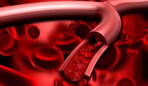 “可降解”人工血管能“再生”血管组织