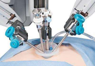 机器人辅助手术为前列腺癌症患者带来更多选择