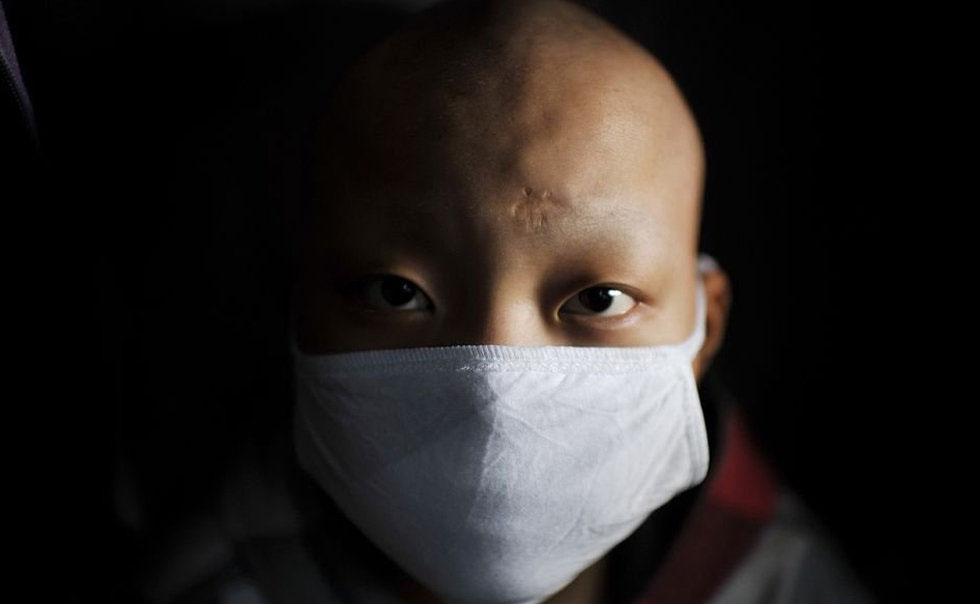 治疗特定白血病，首款IDH1抑制剂Tibsovo获美国FDA批准