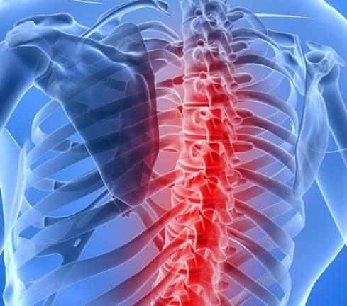 脊髓损伤后功能性恢复有了新治疗策略