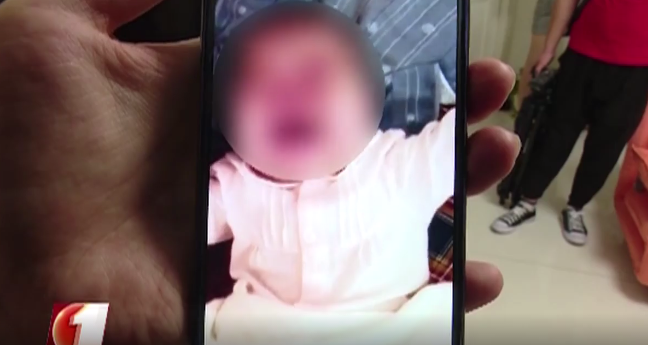 深圳一幼儿接种长春长生疫苗后患百日咳，与问题疫苗不同批次