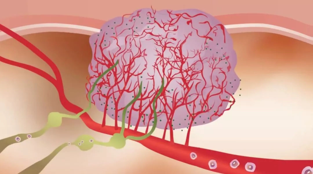 《科学》子刊：癌细胞“大义灭亲”！哈佛科学家将癌细胞改造成冷血抗癌杀手，杀遍全身肿瘤后自杀