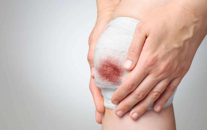 可注射纳米复合晶胶快速止血材料问世