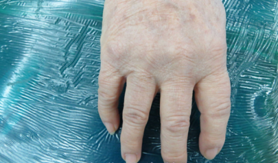 痛风新药研发策略浅析