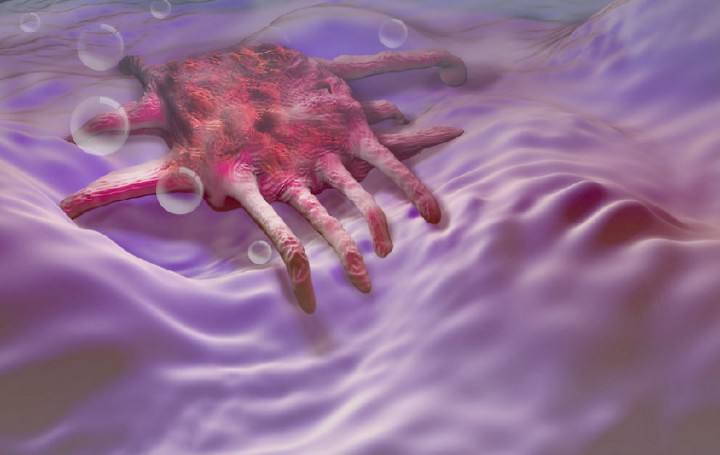 癌细胞派“无人机”打击免疫系统