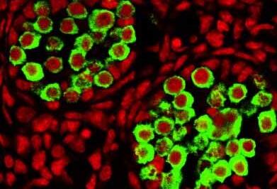 日本筑波大学团队成功制得心脏中胚层细胞