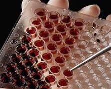 哈佛商业评论：欧盟研发的这款“一滴血诊断”AI产品大有可为