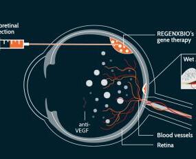 眼科基因疗法将进入平价时代？新药有哪些优势才能卖高价