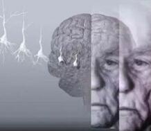 缓解阿兹海默病，数字医疗产品获FDA突破性设备认定