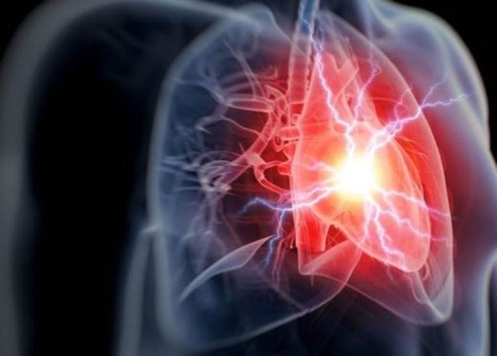 CT血管造影检查有助及早发现心脏病