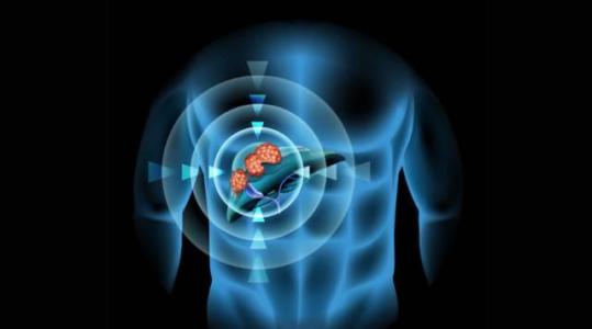 仑伐替尼中国获批，开创肝癌靶向治疗新时代