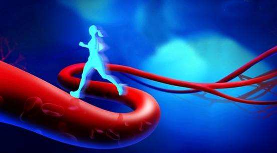 声动力学治疗动脉硬化有新突破，胆固醇流出可加速斑块缩小