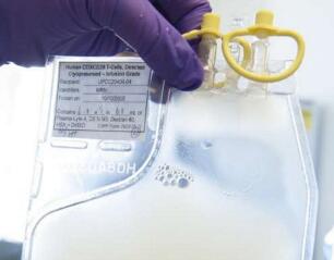 CAR-T治疗后复发？Nature医学揭示背后的意外