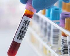 液体活检在癌症检测中应用