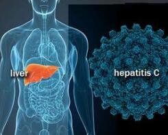 新颁布的基药目录纳入丙肝新药，一线专家呼吁尽快纳入医保