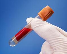 新型血液检测技术有望让癌症患者避免术后不必要的化疗