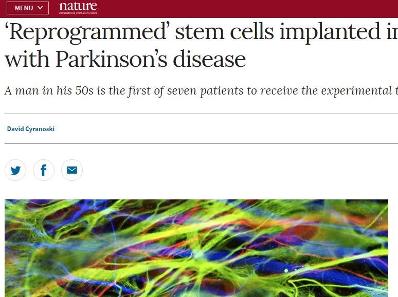 全球首例移植干细胞治疗帕金森人体试验启动