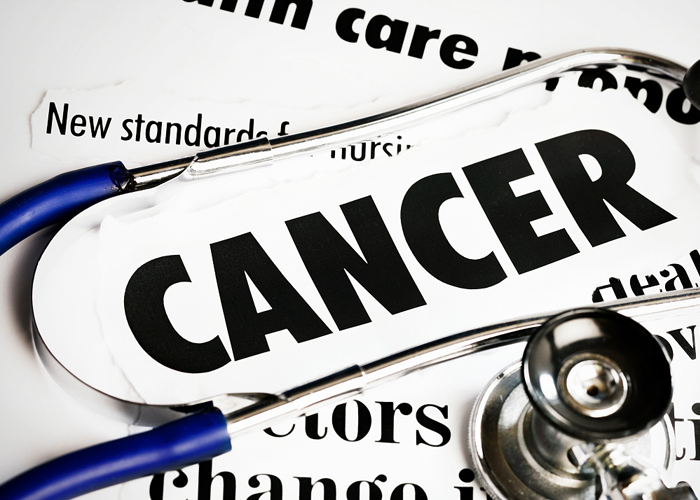 科学家利用胰腺癌的成瘾性来开发新型抗癌疗法