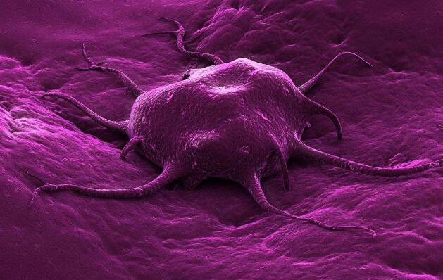 细胞放大镜： 剥开癌细胞的“画皮”