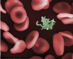 2018 ASH年会值得关注的6大血液病领域