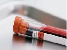 ASH | CAR-T之外，血液癌症还有哪些进展值得关注？