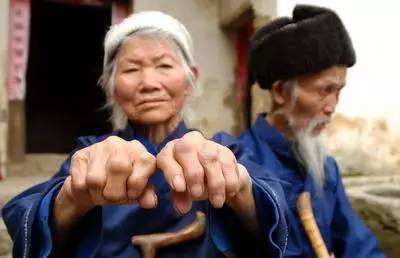 地方病防治专项三年攻坚行动方案（2018—2020年）出台，看看有没有你家？