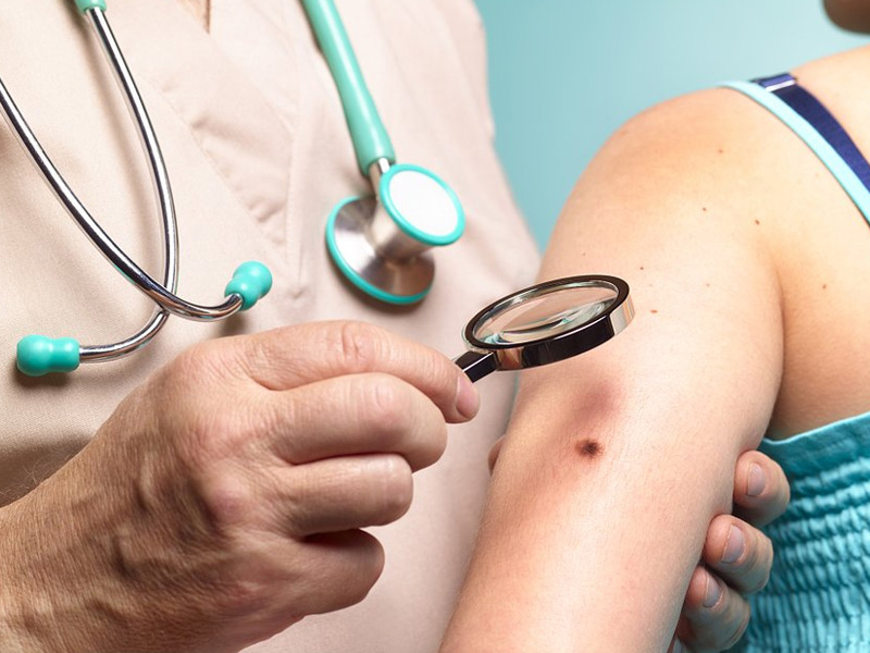 裸眼诊断皮肤癌难以确保准确率