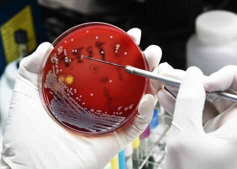 脐带血干细胞产品致12人发生严重感染，美CDC及FDA已介入调查