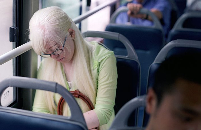 这类疾病，医保支付有了新思路