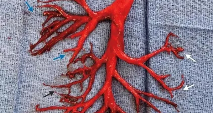 2018年十大奇怪病例