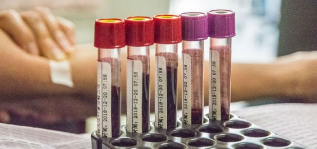 爱康私有化完成，每普通股41.20美元