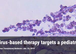 用病毒杀死癌细胞！治疗恶性儿童癌症，溶瘤病毒又有新进展