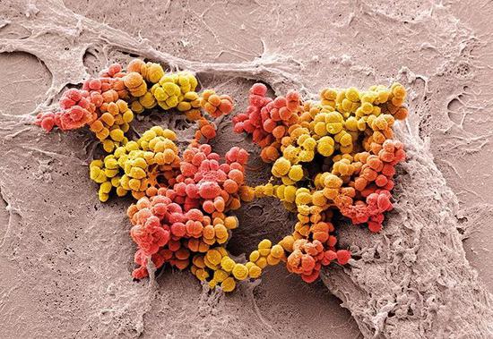 我们离微生物群改善感染湿疹痤疮，还有多远？