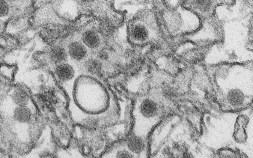 《科学》网站：美国“悄悄”重启争议病毒实验