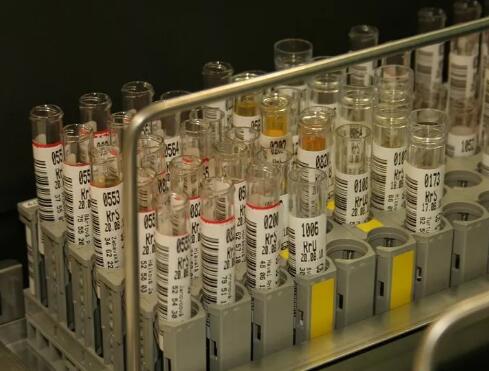 小便发黄，是上火吗？一文看懂各种颜色尿液可能预示什么病