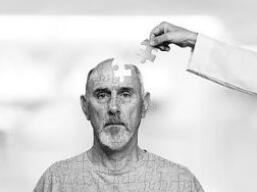 3个月之后，人类将迎百年抗争阿茨海默最激进尝试