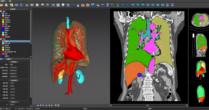 昕健医疗：深耕骨科3D打印技术, 挑战定制化高端市场