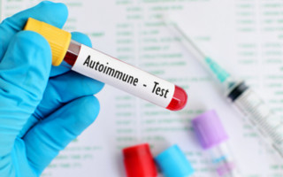 高瓴制药获数千万元战略融资， 推进自身免疫病创新药研发