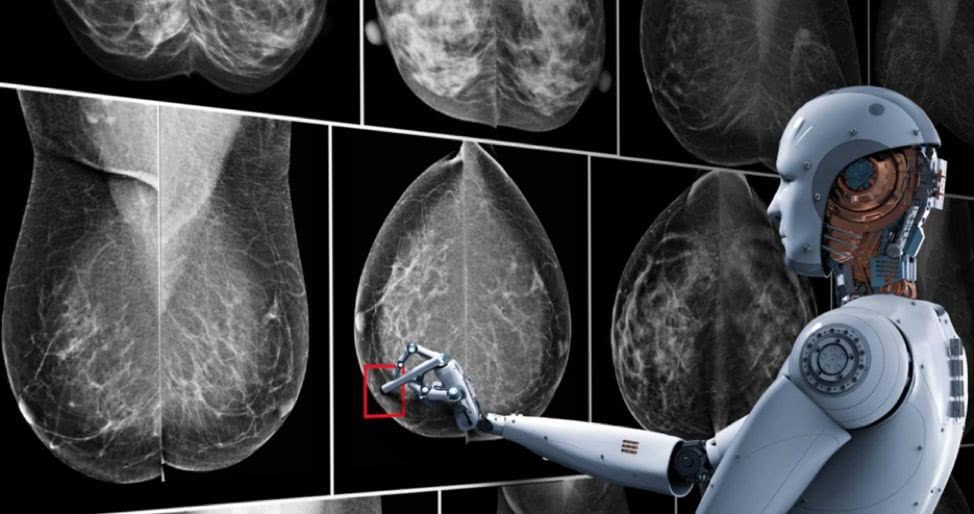 AI，会让放射科医生下岗吗？