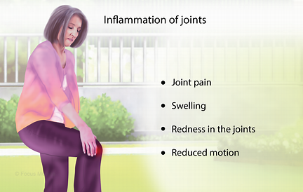 超声波或能用于神经调节疗法，未来有望代替可植入装置