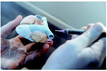 巨头入局，超35种3D打印植入物获批，生物组织打印产业前景看好【医疗3D打印上篇】