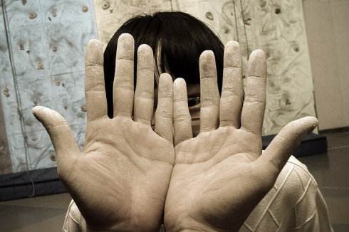 全球首批！艾伯维银屑病新药在日本上市