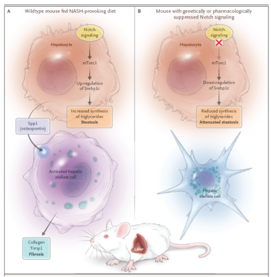 Science子刊：肝细胞Notch的激活可导致非酒精性脂肪型肝炎进展为肝纤维化