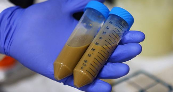 首个临床证据！粪便移植可助力癌症免疫治疗