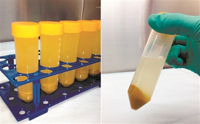 便便治病？广东目前有多家医院开展粪菌移植治疗