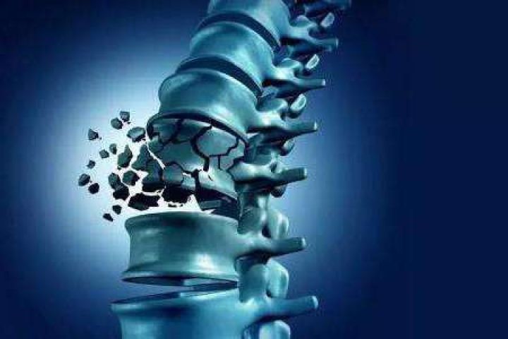 骨质疏松症靶点结构精准解析